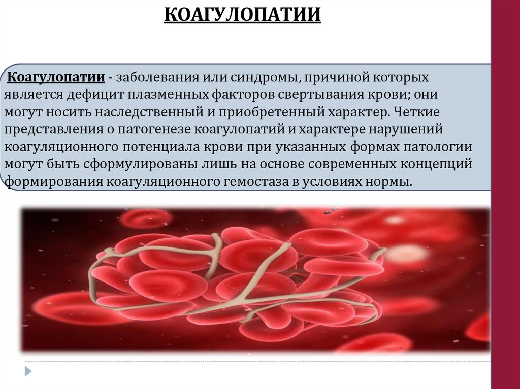 КОАГУЛОПАТИИ