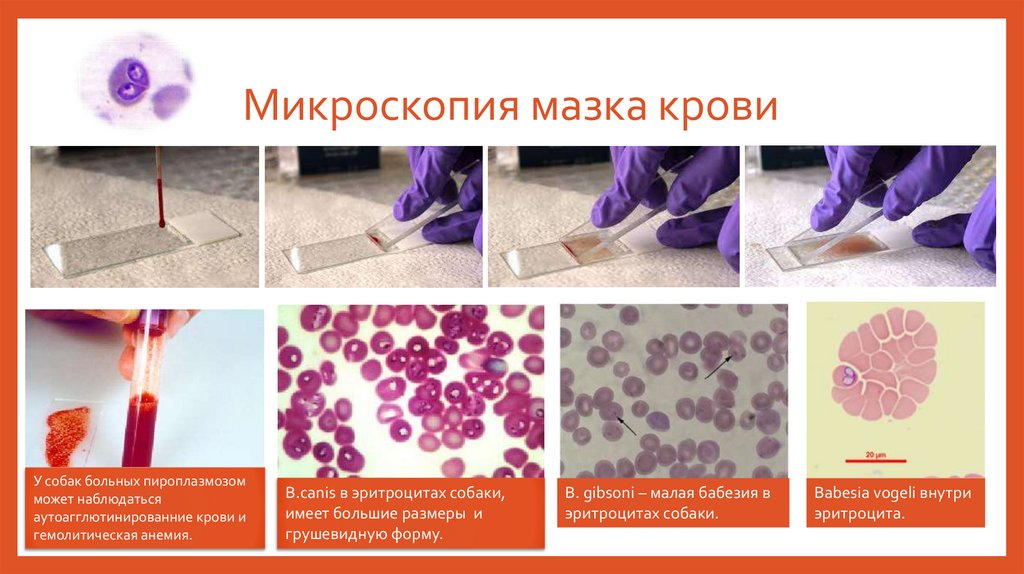 Микроскопия мазка крови