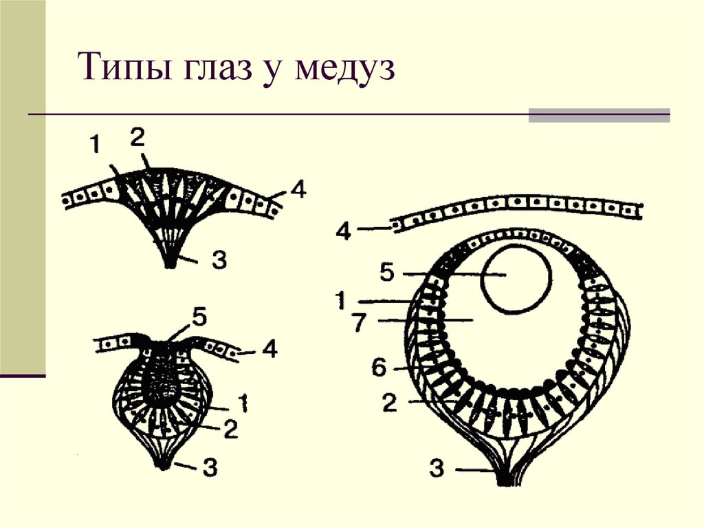 Типы глаз у медуз