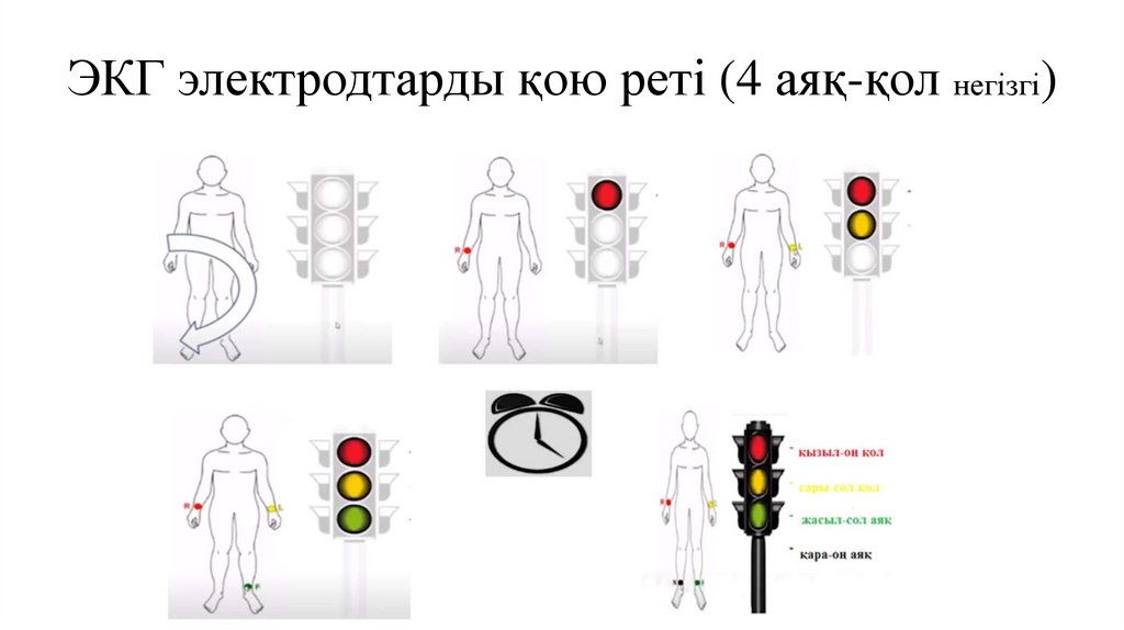 ЭКГ электродтарды қою реті (4 аяқ-қол негізгі)