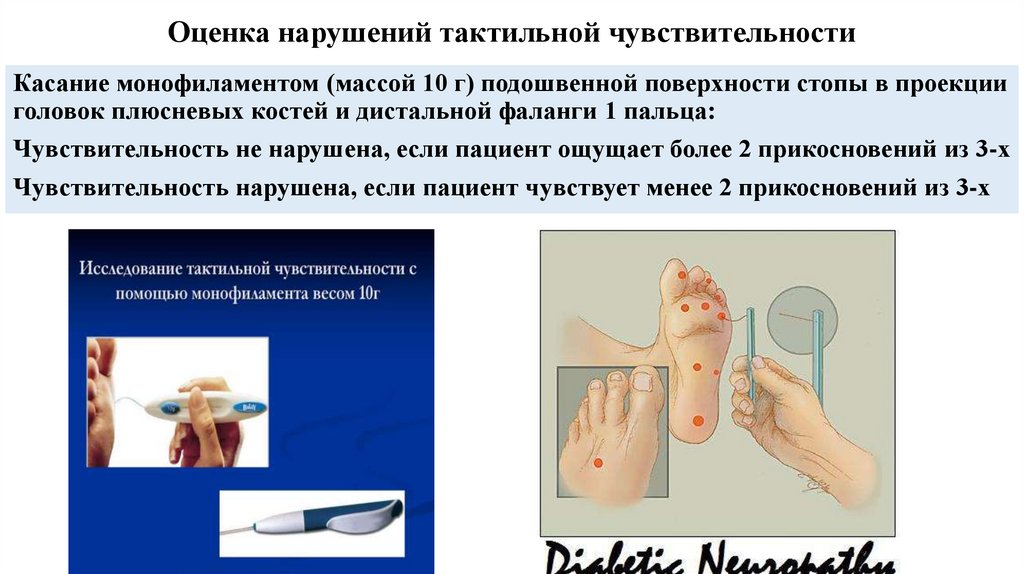 Оценка нарушений тактильной чувствительности