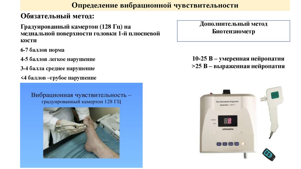 Определение вибрационной чувствительности