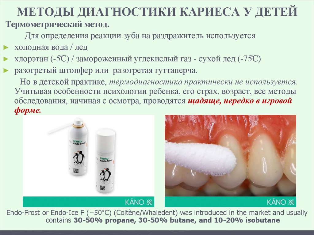 МЕТОДЫ ДИАГНОСТИКИ КАРИЕСА У ДЕТЕЙ