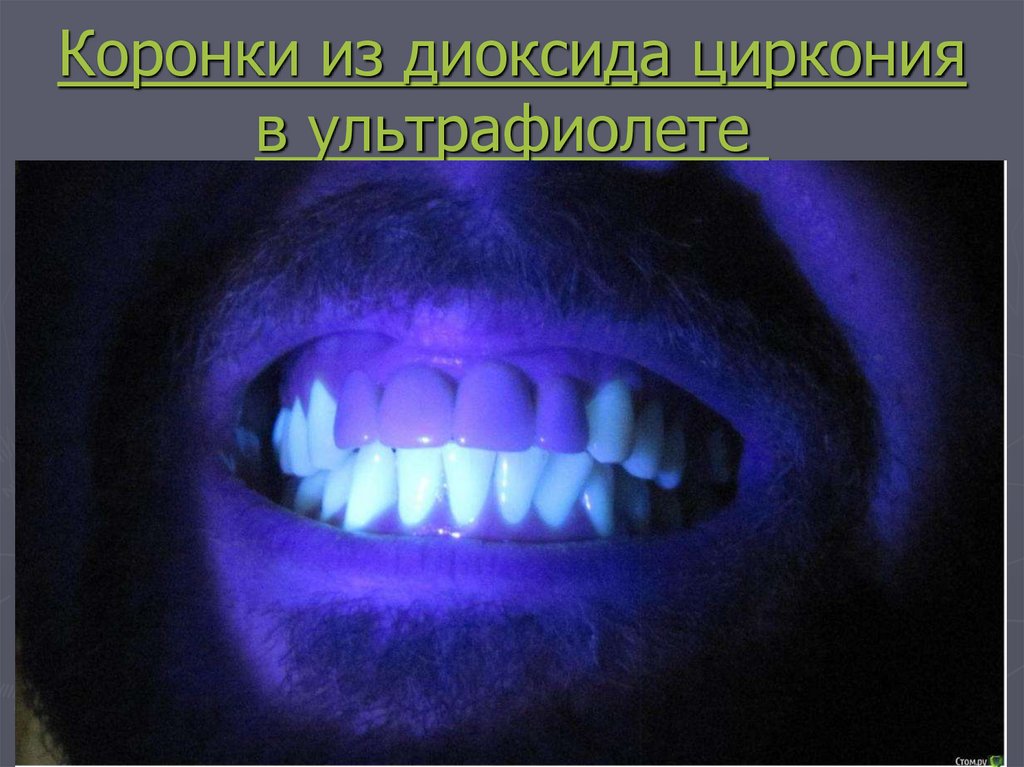 Коронки из диоксида циркония в ультрафиолете 