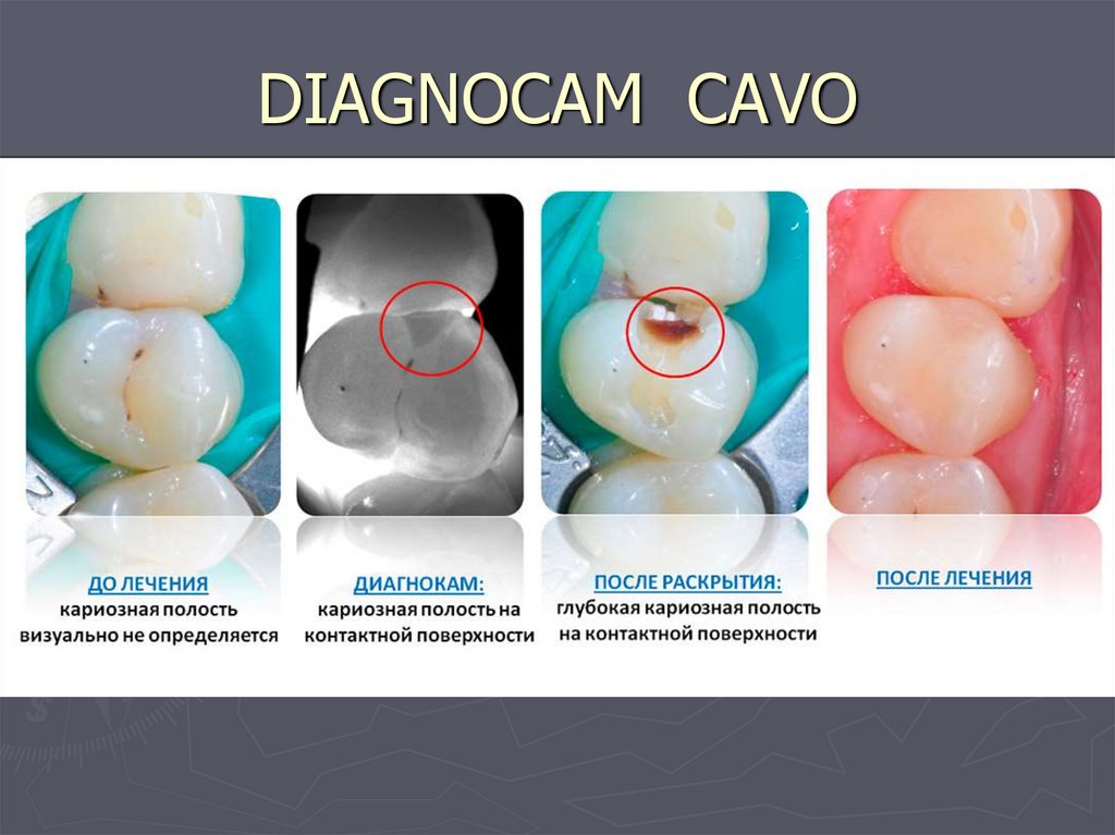 DIAGNOCAM CAVO