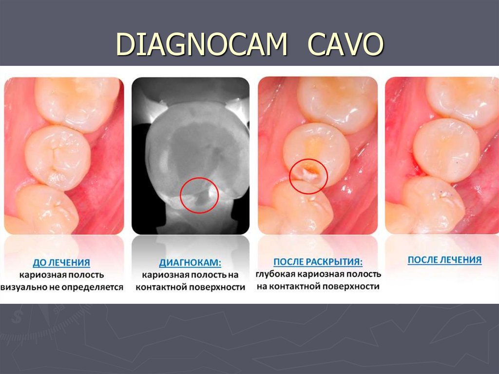 DIAGNOCAM CAVO