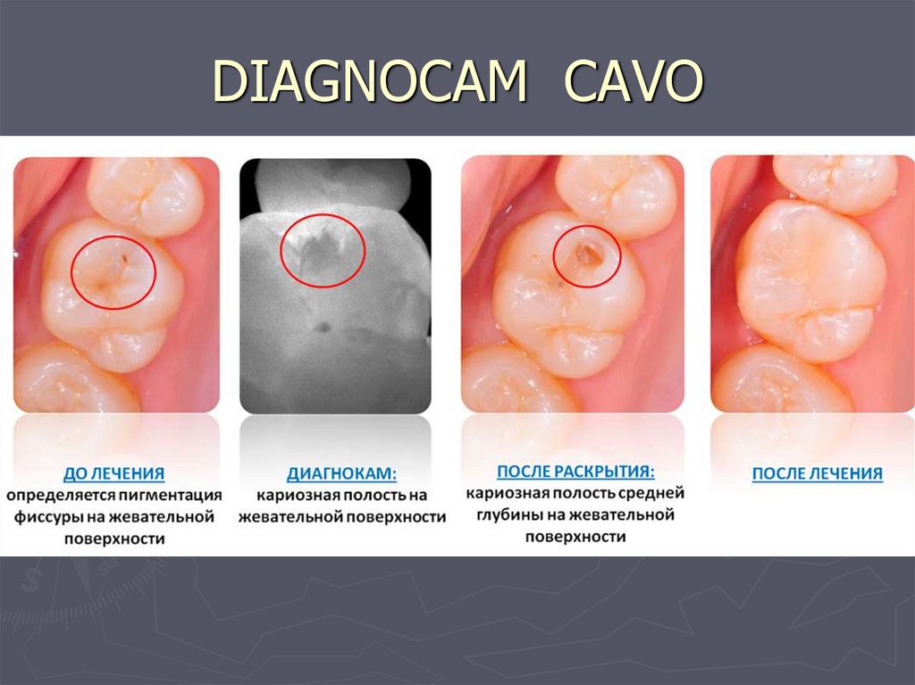 DIAGNOCAM CAVO