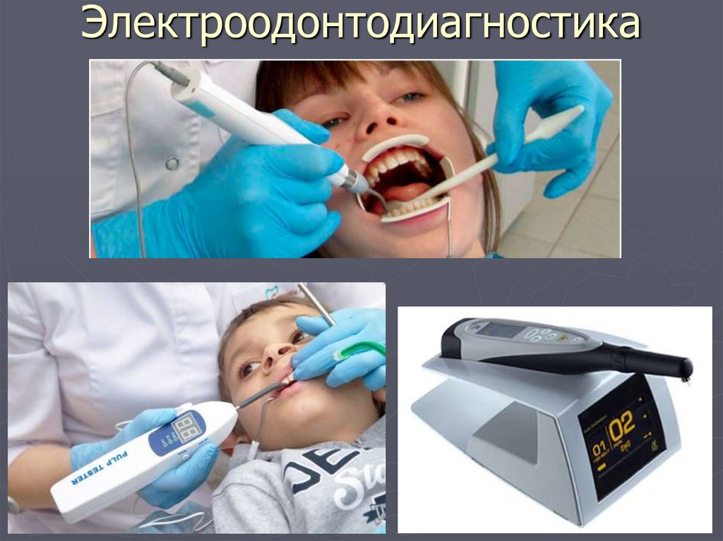 Электроодонтодиагностика
