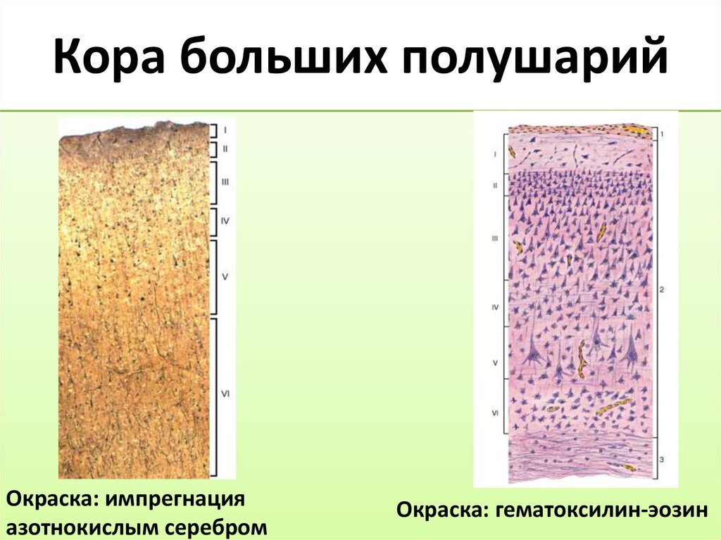 Кора больших полушарий