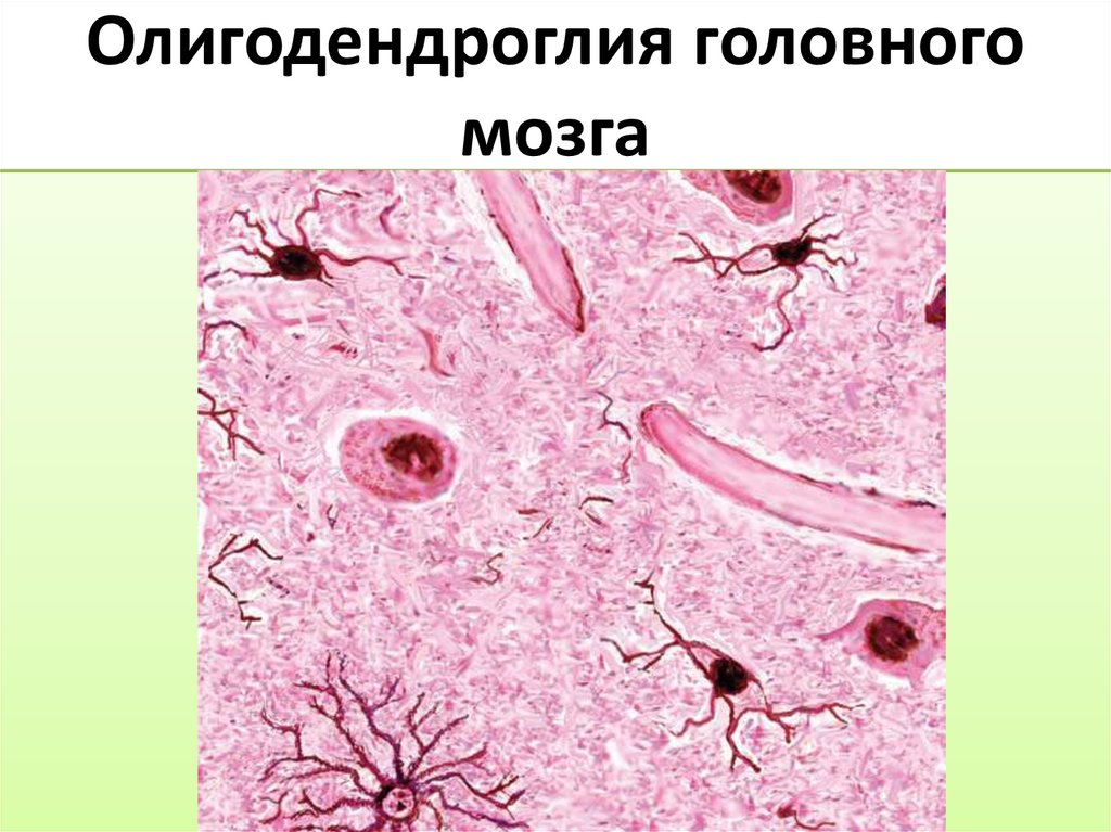 Олигодендроглия головного мозга