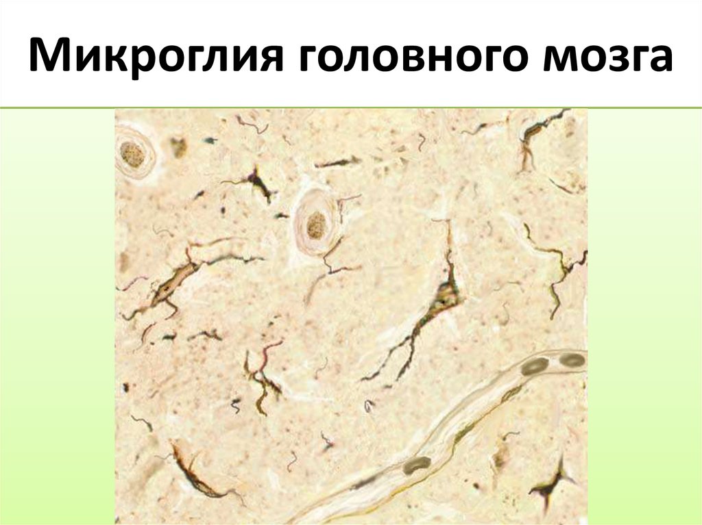 Микроглия головного мозга