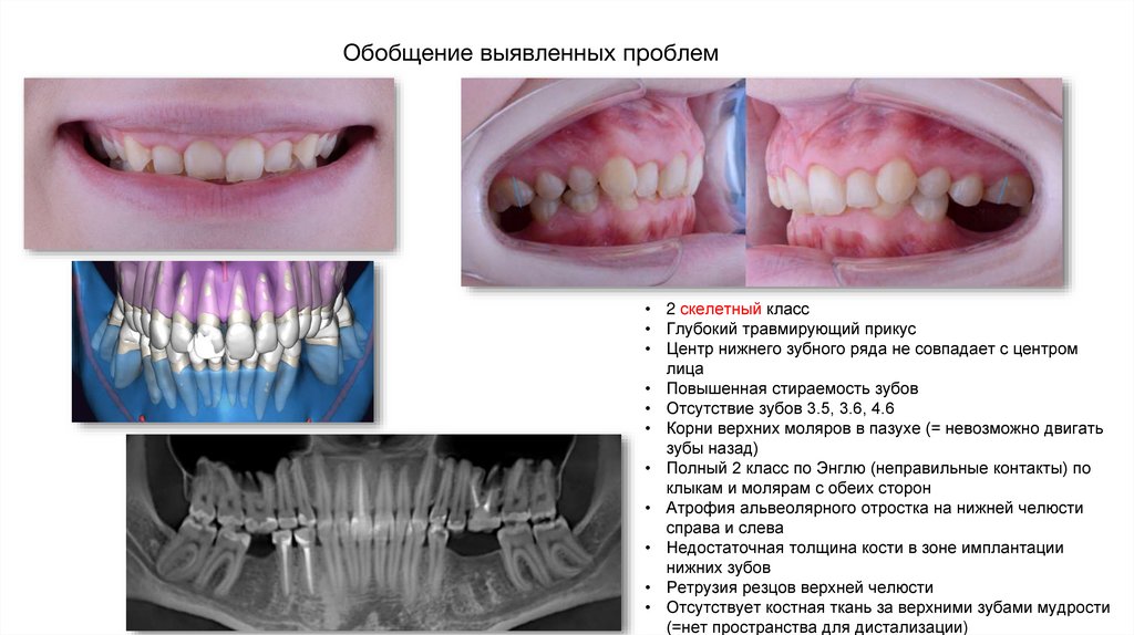 Обобщение выявленных проблем