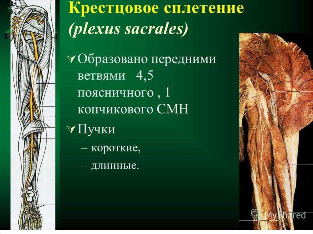 Крестцовое сплетение