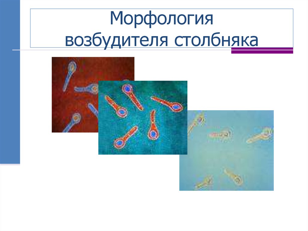Морфология возбудителя столбняка