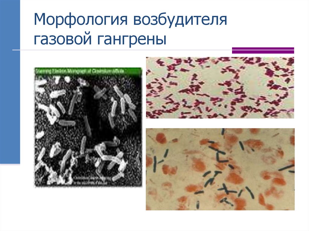 Морфология возбудителя газовой гангрены