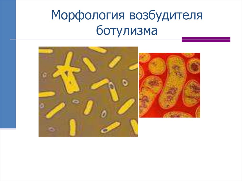 Морфология возбудителя ботулизма