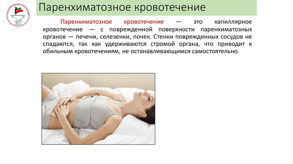 Паренхиматозное кровотечение