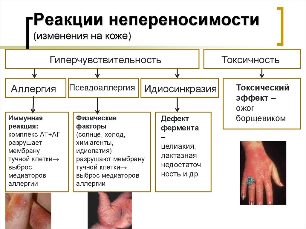 Реакции непереносимости (изменения на коже)