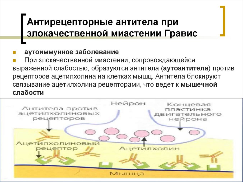 Антирецепторные антитела при злокачественной миастении Гравис