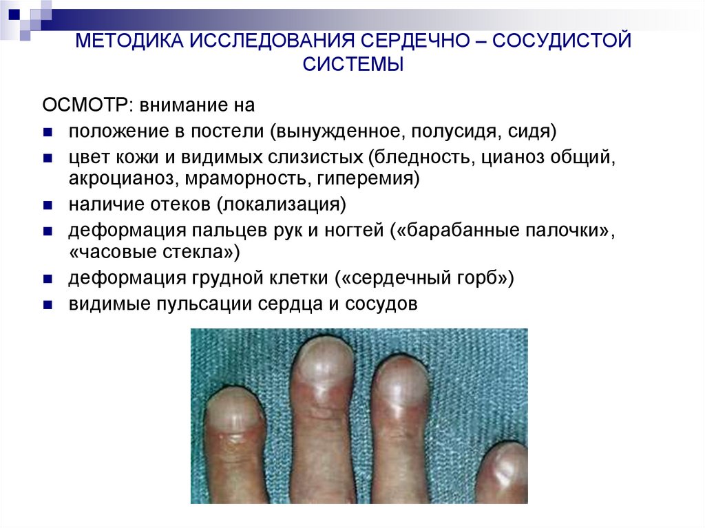 МЕТОДИКА ИССЛЕДОВАНИЯ СЕРДЕЧНО – СОСУДИСТОЙ СИСТЕМЫ