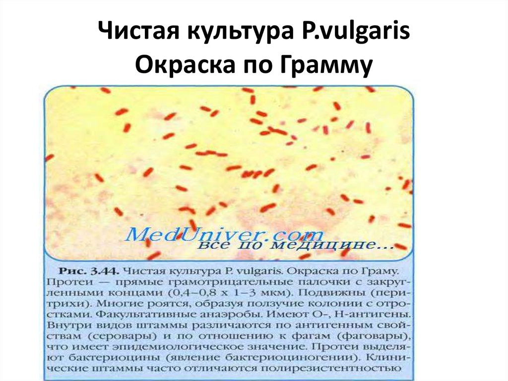 Чистая культура P.vulgaris Окраска по Грамму