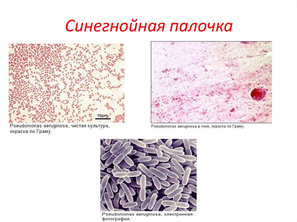 Синегнойная палочка