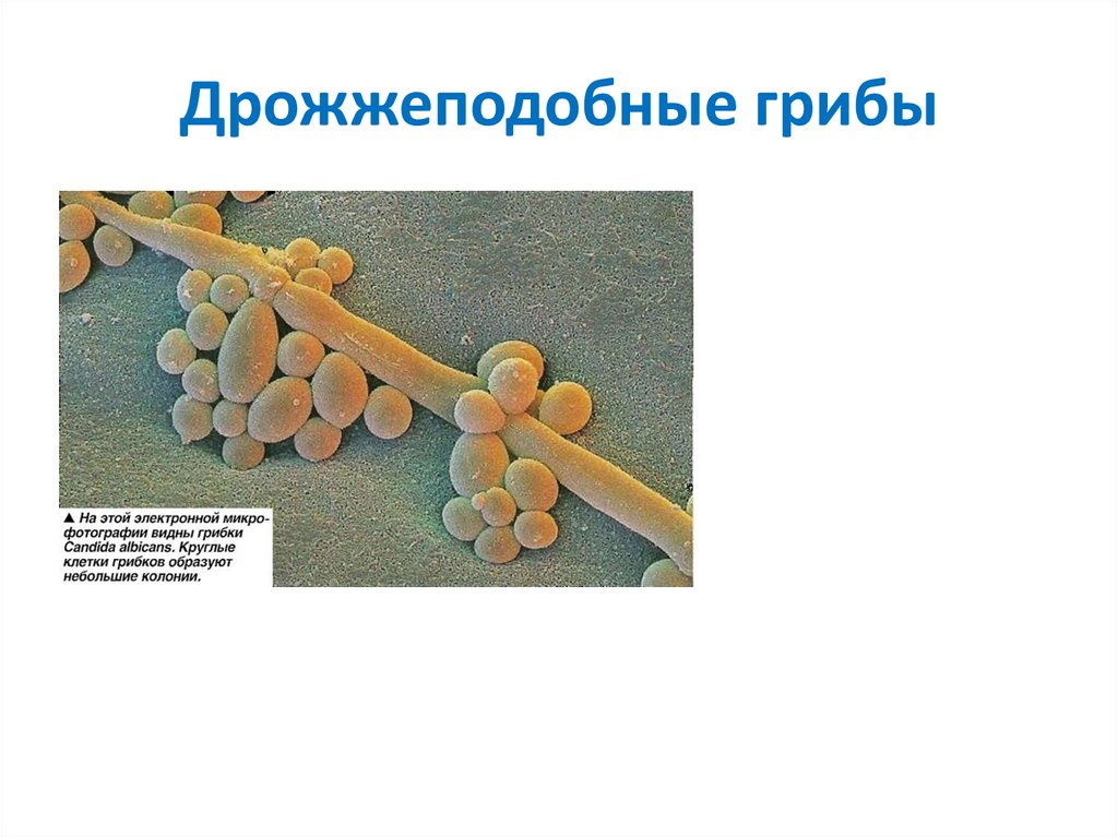 Дрожжеподобные грибы