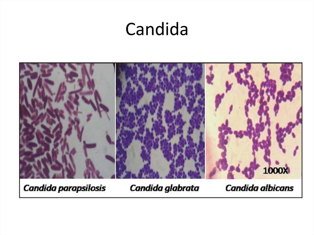Candida