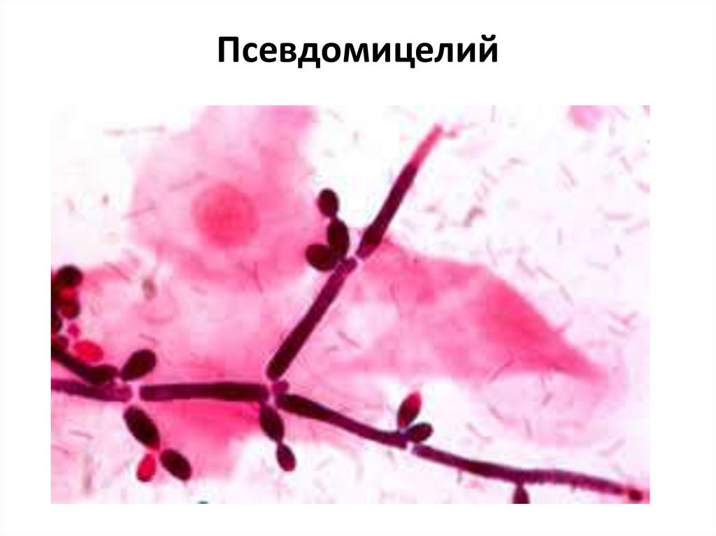 Псевдомицелий