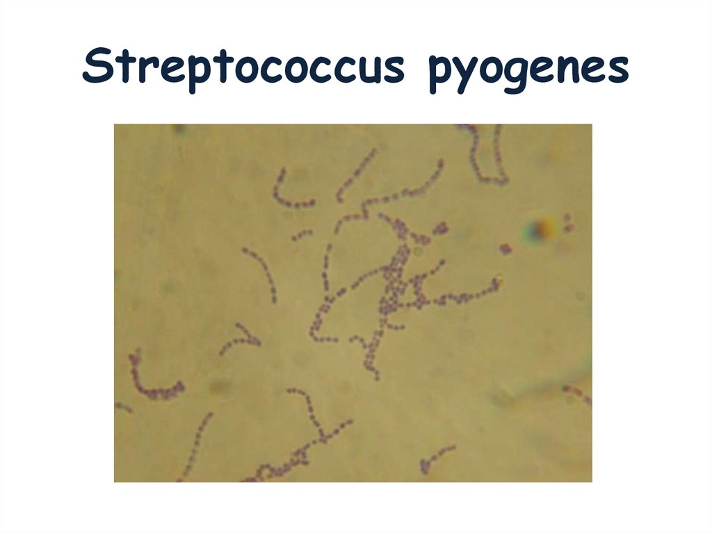 Streptococcus pyogenes