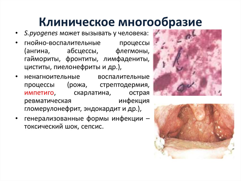 Клиническое многообразие