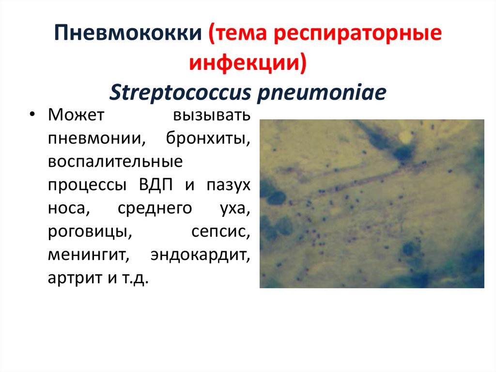 Пневмококки (тема респираторные инфекции) Streptococcus pneumoniae