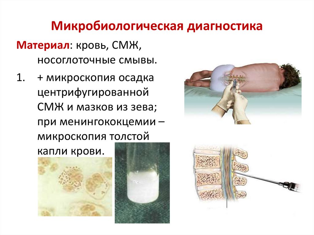 Микробиологическая диагностика