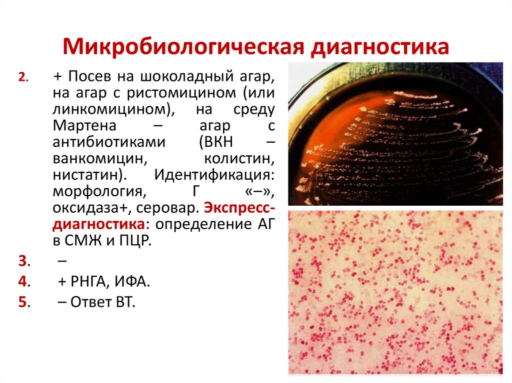Микробиологическая диагностика
