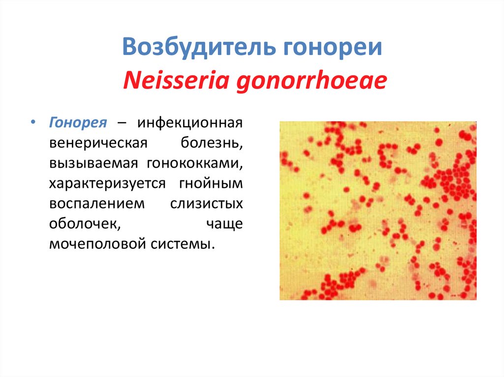 Возбудитель гонореи Neisseria gonorrhoeae