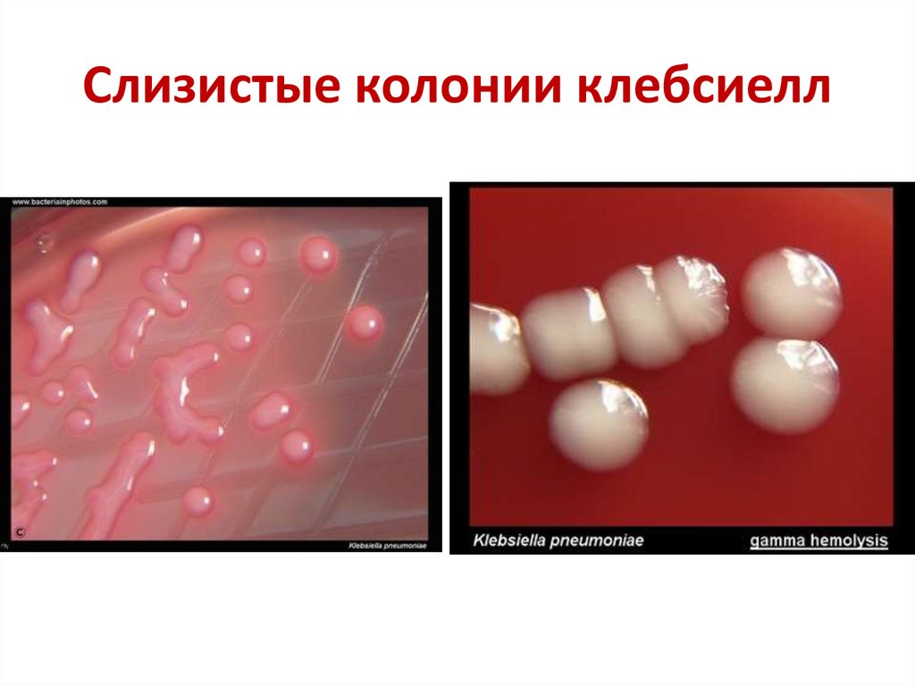 Слизистые колонии клебсиелл