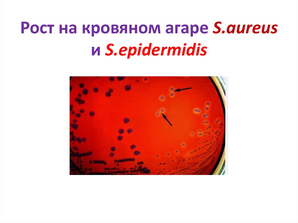 Рост на кровяном агаре S.aureus и S.epidermidis
