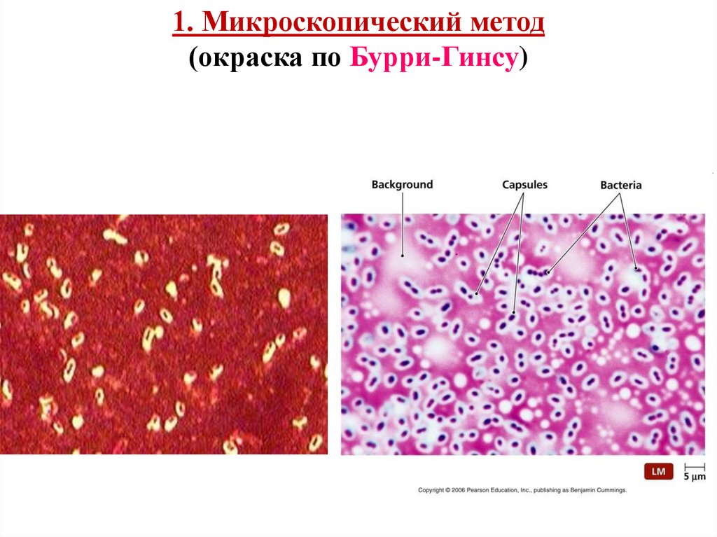 1. Микроскопический метод (окраска по Бурри-Гинсу)