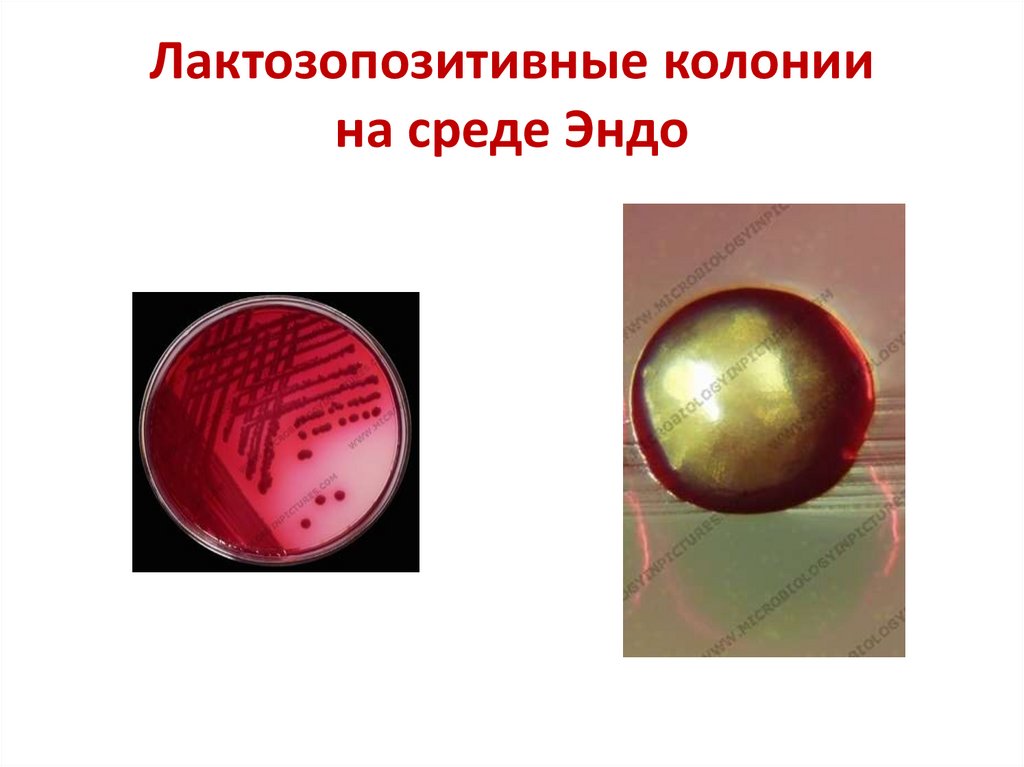 Лактозопозитивные колонии на среде Эндо