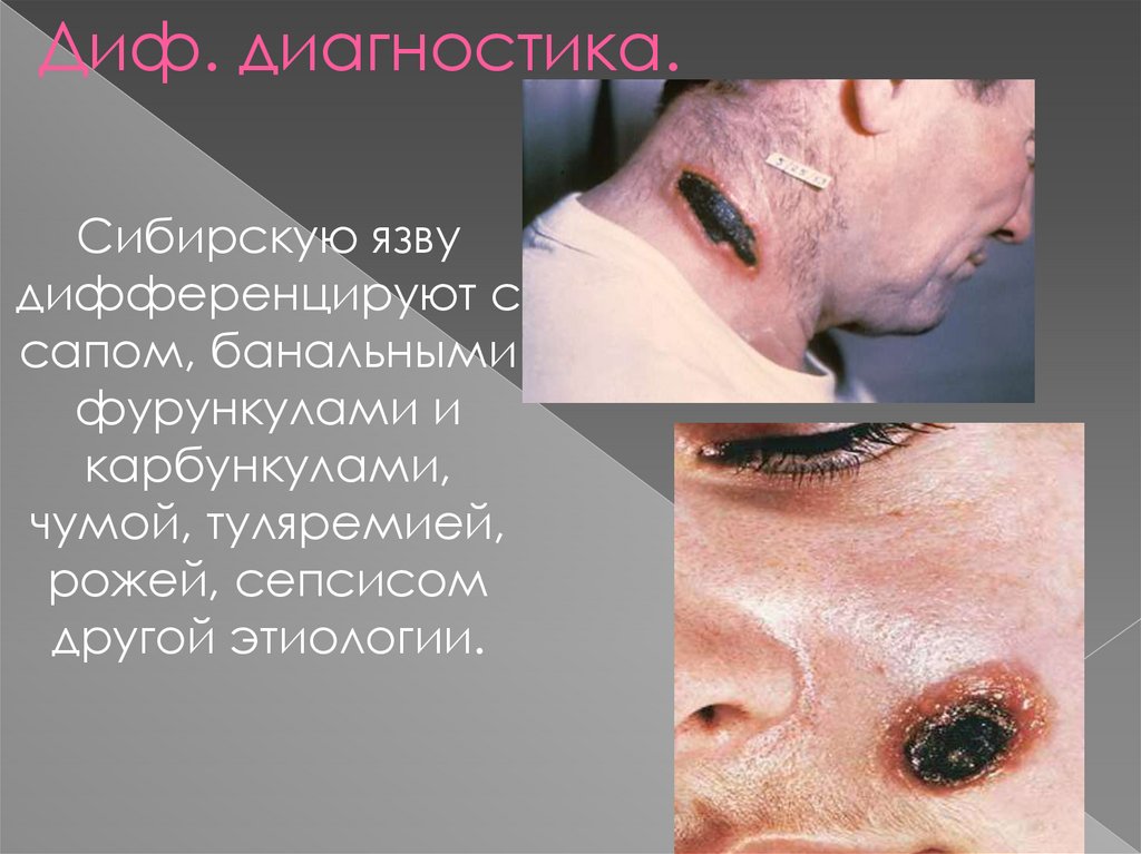 Диф. диагностика.