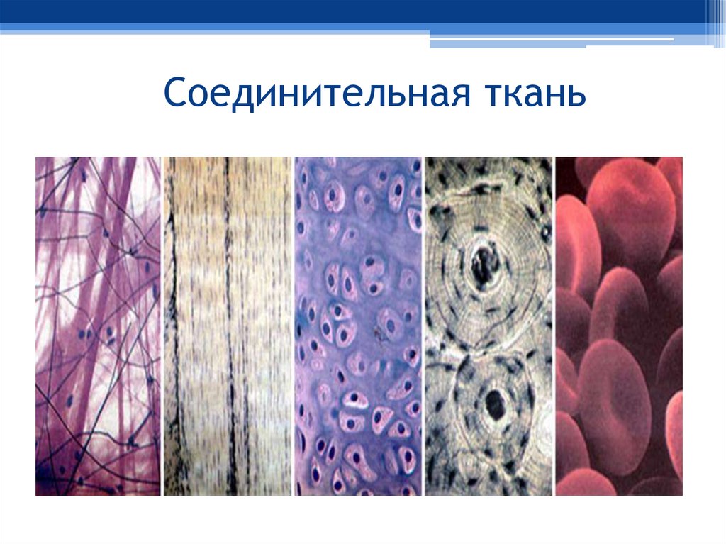 Соединительная ткань