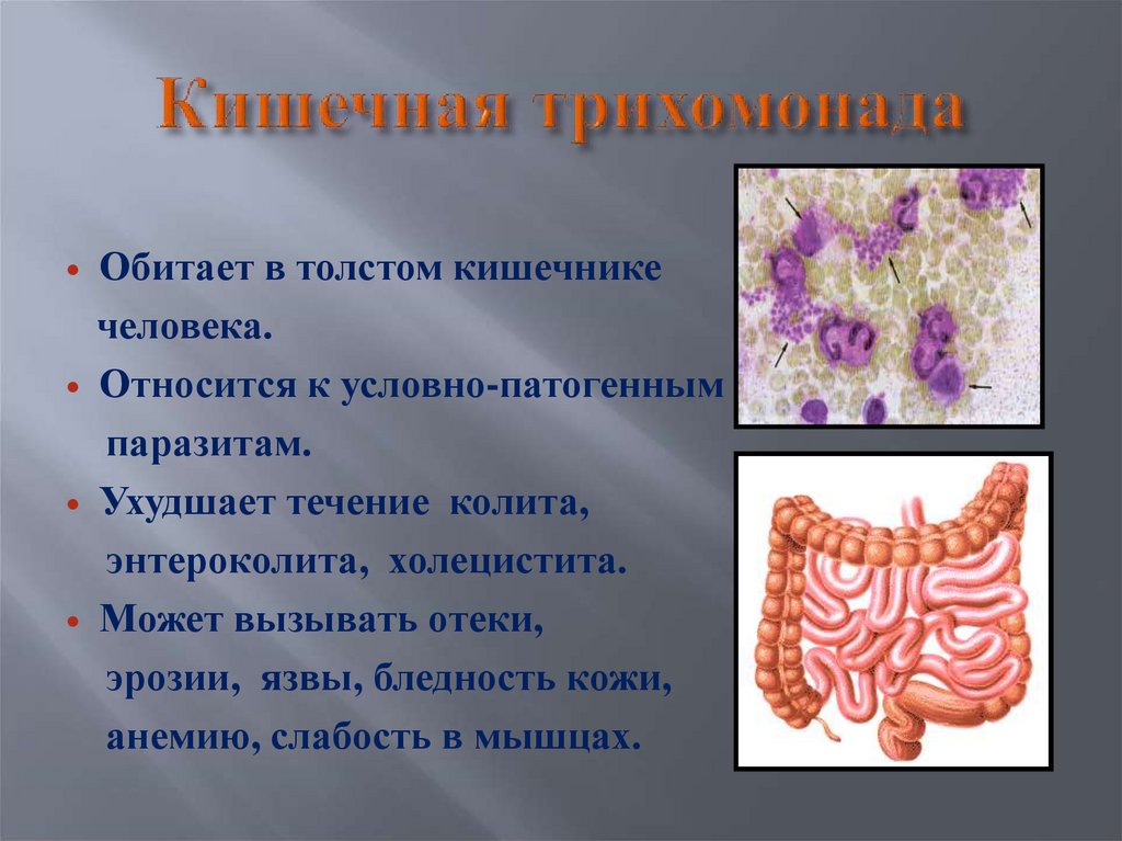 Кишечная трихомонада