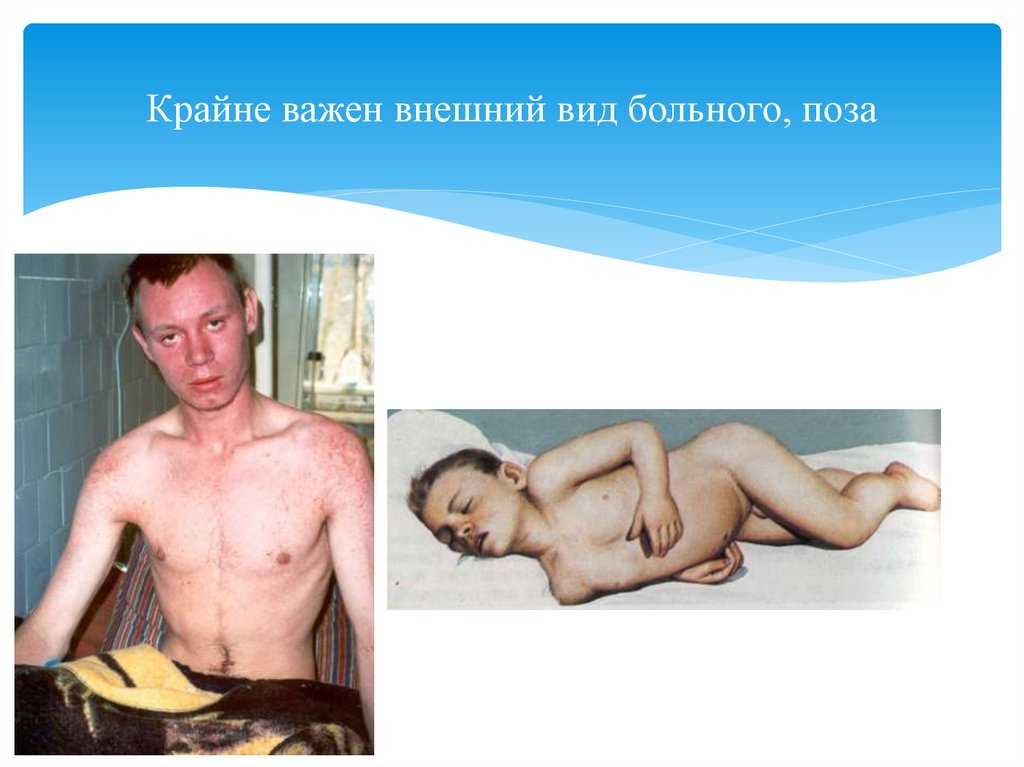 Крайне важен внешний вид больного, поза