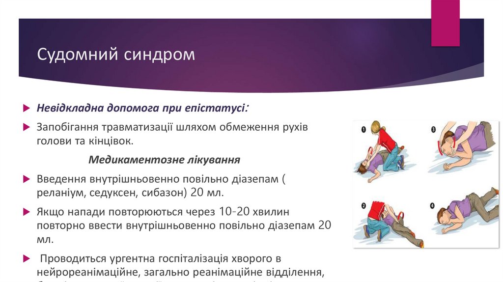 Судомний синдром