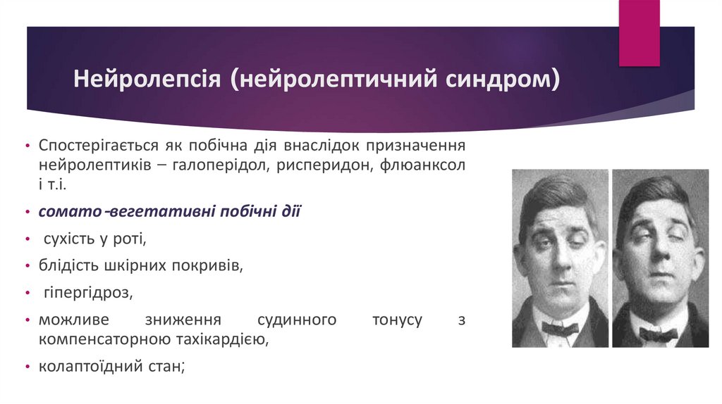 Нейролепсія (нейролептичний синдром) 
