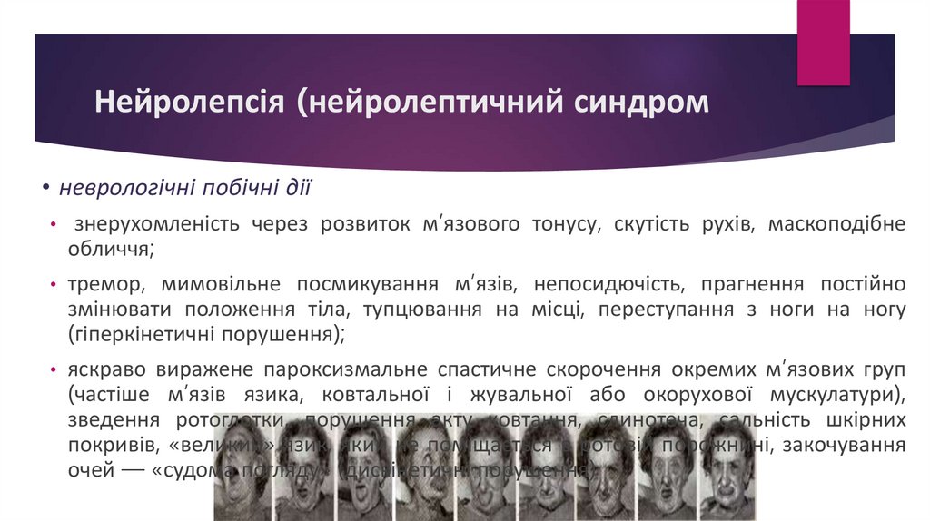 Нейролепсія (нейролептичний синдром