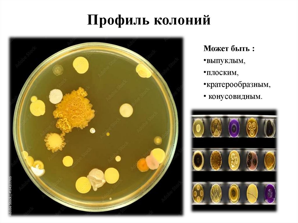 Профиль колоний