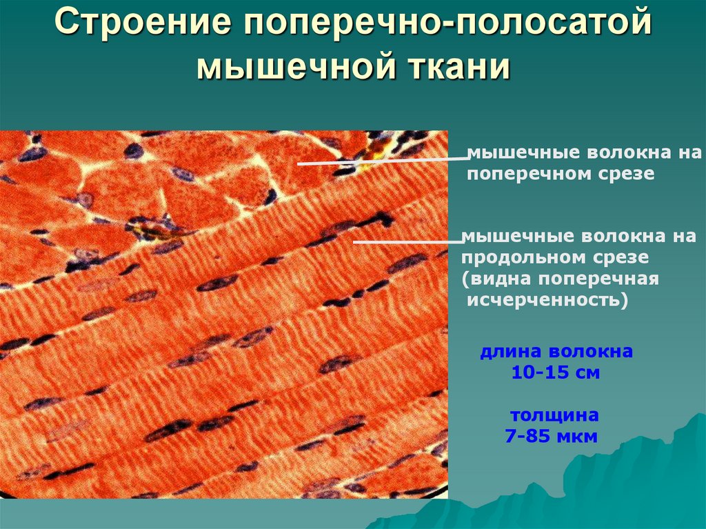 Строение поперечно-полосатой мышечной ткани