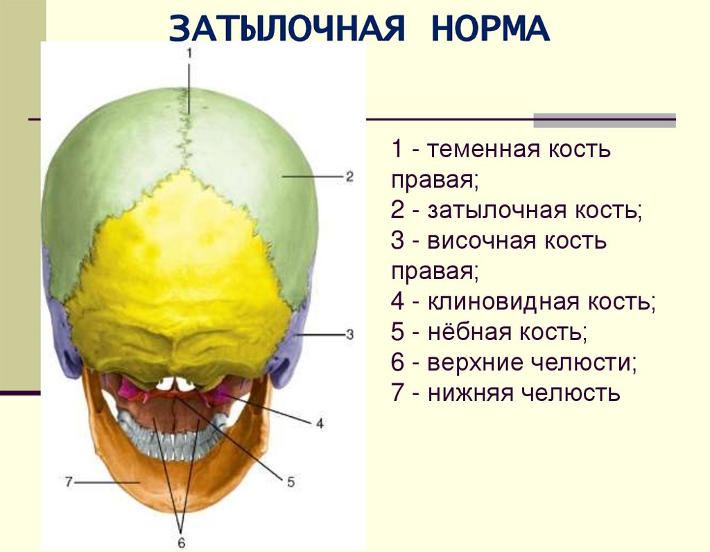 1 - теменная кость правая; 2 - затылочная кость; 3 - височная кость правая; 4 - клиновидная кость; 5 - нёбная кость; 6 -