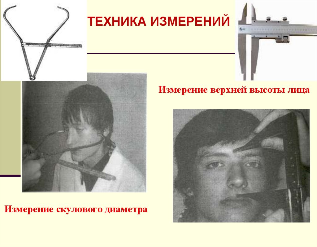 Измерение скулового диаметра